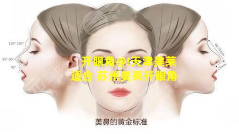 开眼角@!天津美莱适合 苏州美莱开眼角